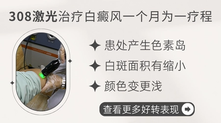 哺乳期女性可以用治白癜风的外用药吗