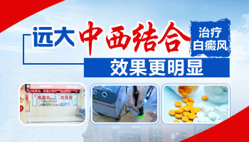 头部白癜风药物能治疗吗
