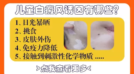 小孩为什么突然会出现白斑