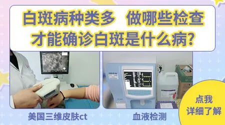 儿童白斑早期图片大全
