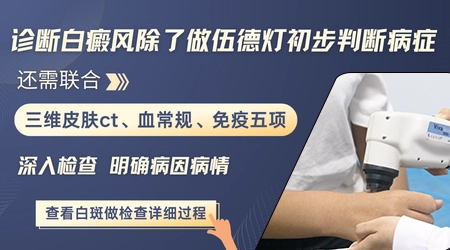白斑只做伍德灯检查够不够