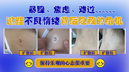 屁股上的白斑扩散了是什么造成的