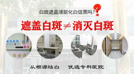 白癜风遮盖液能长期使用吗