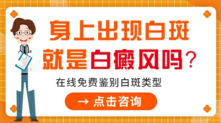 白癜风图片鉴别和自测 在家就能完成初步判断