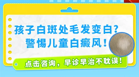 儿童身上的白斑毛发也变白了怎么办