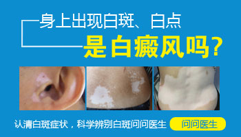 孩子的嘴角边发白是白癜风吗