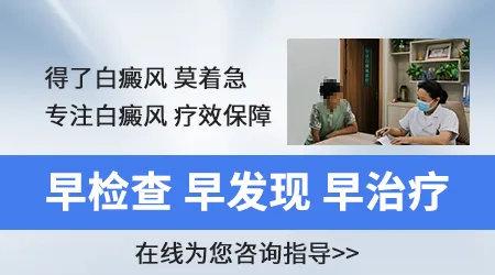 白癜风图片鉴别和初诊 不用跑医院先看图判断