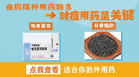 手部白癜风涂抹什么药效果好