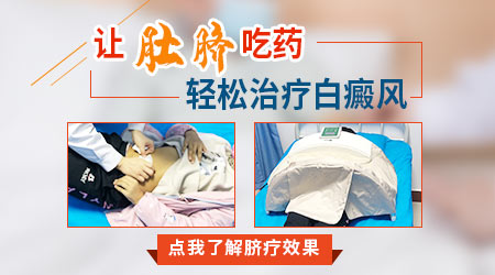 中药脐疗治白癜风的效果如何 费用高吗