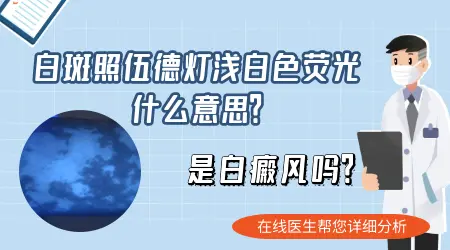 伍德灯检查白斑有浅白色荧光反应