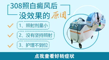 白癜风光疗几次后没反应是不是对我无效