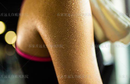 白癜风植皮效果对比 植皮之后和正常皮肤一样吗 