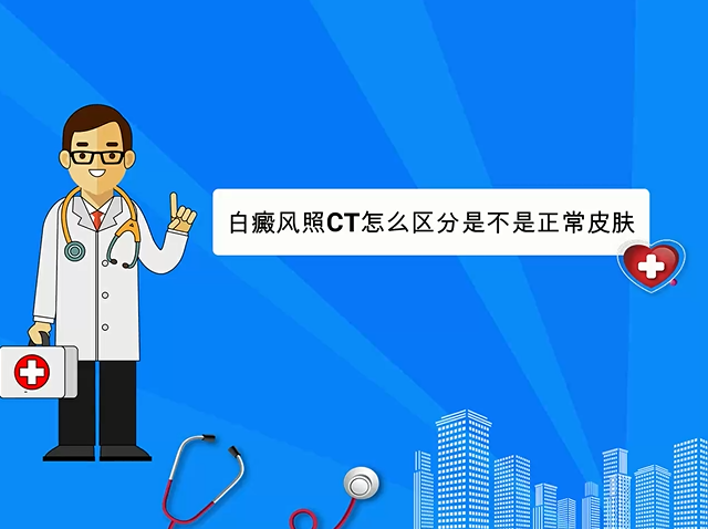 白癜风照CT怎么区分是不是正常皮肤