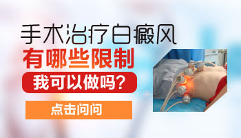 白癜风不照激光还有其他治疗方法吗