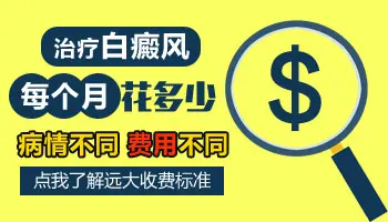 白癜风怎么治疗花钱少
