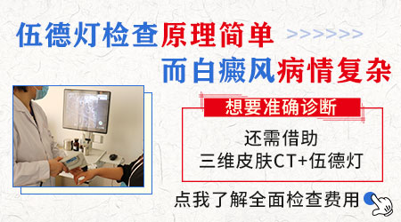 伍德灯下的各种白斑图解