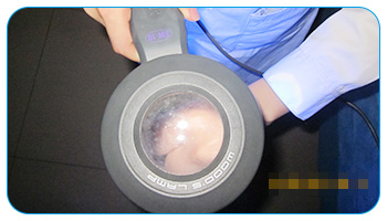 普通白斑和白癜风自测