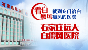 胸前和脖子上的白癜风照一次308激光多少钱