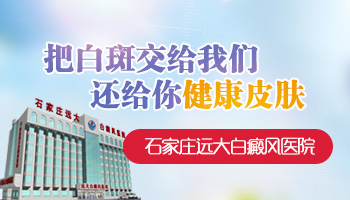 邯郸哪家医院治白斑效果好