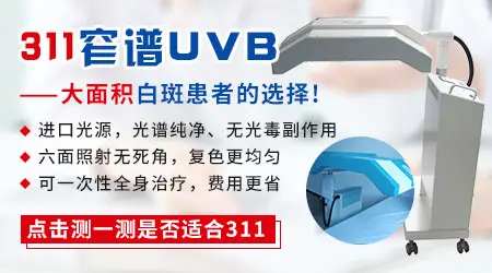 白癜风uvb紫外线光疗仪和其他厂家的比较