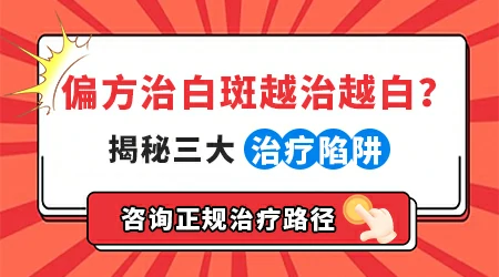 网上宣传的快速消白斑偏方可信吗