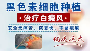 白癜风手术后如何观察好转迹象