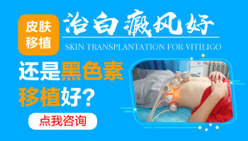 表皮移植和黑色素移植的区别 哪个能治好白癜风