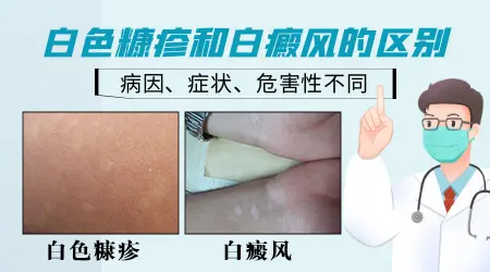 身上出现白斑白点怎么回事
