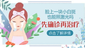 沧州白癜风医院是怎么治疗白斑的