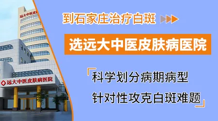 石家庄地区医院哪个看白癜风白斑好