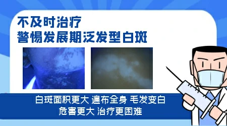 伍德灯下白斑面积比肉眼看到的大是怎么回事