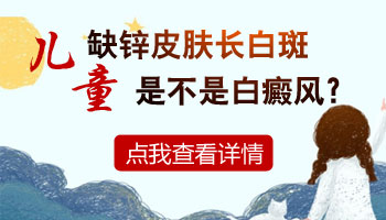 宝宝缺锌长白斑 身上白斑是什么病