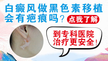 白癜风做黑色素细胞移植后会留下疤痕吗