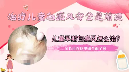 儿童白癜风早期治疗效果怎么样