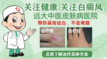 艾叶擦拭白斑真实案例