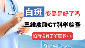 308照白癜风到什么程度可以不照了