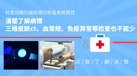 伍德灯检查能确诊所有白斑病吗