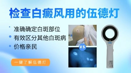 刚出现的白斑用伍德灯能查出来吗