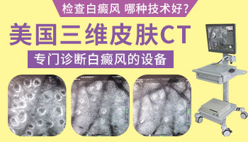 儿童白癜风早期有哪些症状表现