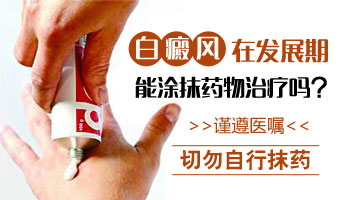 白斑发展期可以抹什么药