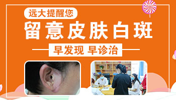 排除白斑是白癜风的方法
