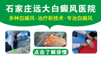 有没有在专科白癜风医院治好白斑的