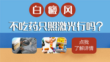 白癜风不吃药只照308光疗可以吗