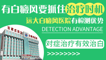 邯郸哪家医院能治好白癜风