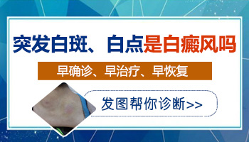 唇线发白是得了白癜风吗