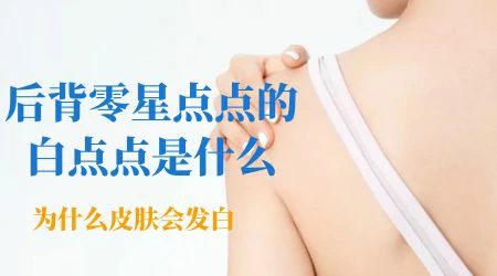 后背上起小白点是怎么回事