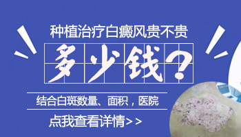 河北石家庄远大白癜风医院治疗贵不贵