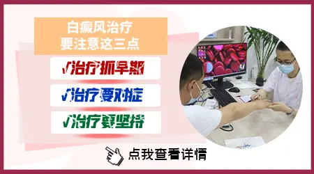 308激光配合什么药治疗白癜风见效快