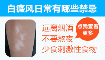 白癜风会导致睫毛头发变白吗