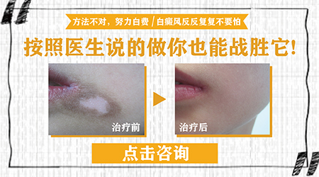 远大白癜风医院是公立还是私立